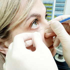 Инъекционное лечение глаз